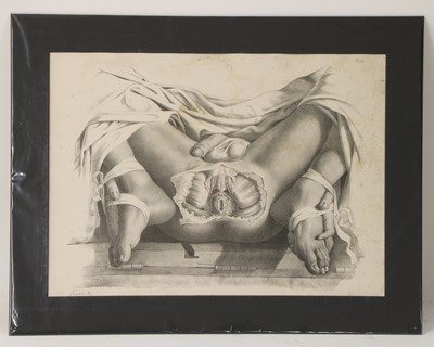 Lot 529 - ANATOMICAL AUTOPSY