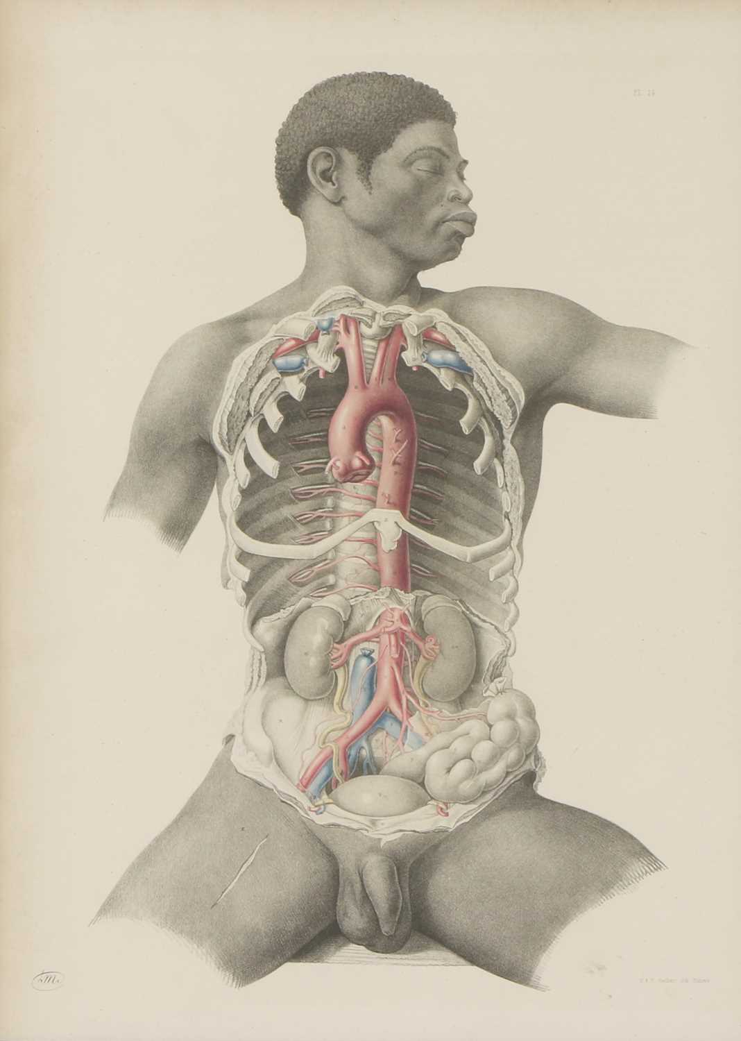 Lot 529 - ANATOMICAL AUTOPSY